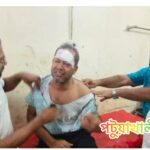 কুয়াকাটায় কৃষকলীগ সভাপতিকে কুপিয়ে জখম